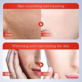 2PCS Crema Acido Kojico, crema Kojic Acid, Desmanchadora de manos – Sin Sensación Pegajosa para Todo Tipo de Pieles, No Pegajosa – Tratamiento Intensi