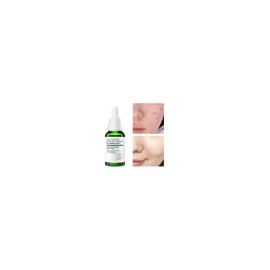 Sérum Facial Universo en Linea Ácido Salicílico Antiacné 30ml Piel Todo Tipo