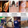 4 Sizes Cupping Therapy Set-Professional Cupping Therapy Studio and Household