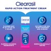 Clearasil Rapid Action Treatment Cream 25ml Pack of 3