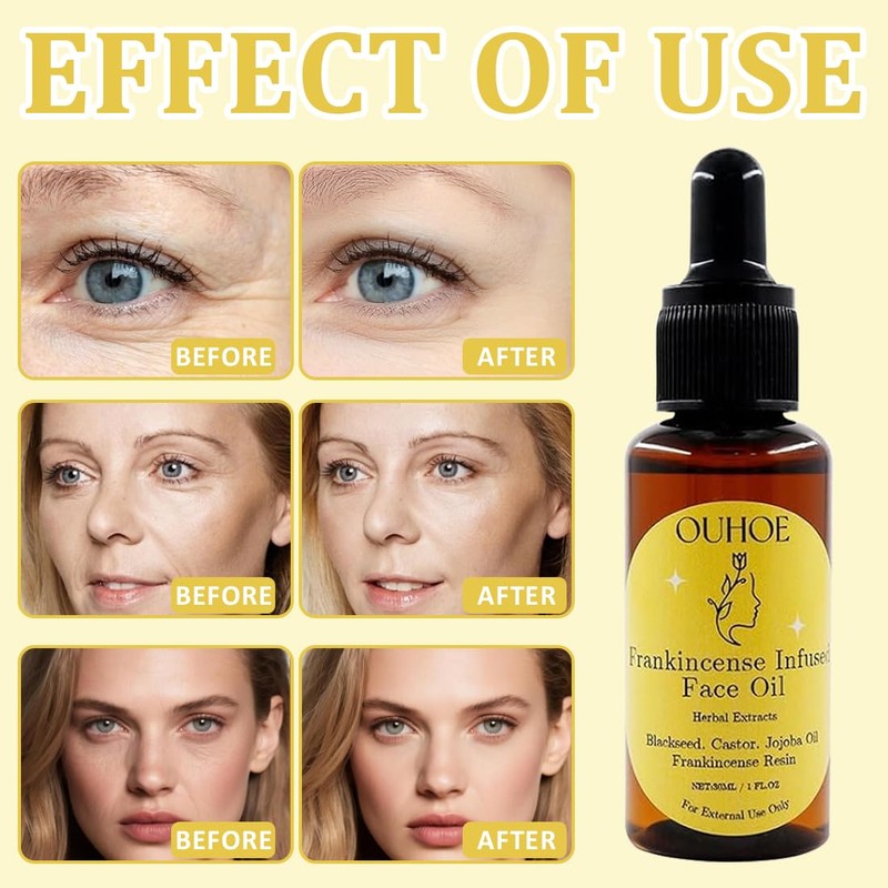 Frankincense Resin Oil for Face, Anti-Ageing Castor Oil for Face