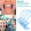 KEPYATI 6 Shape Mouth Opener Dental Mouth Opener Toy for