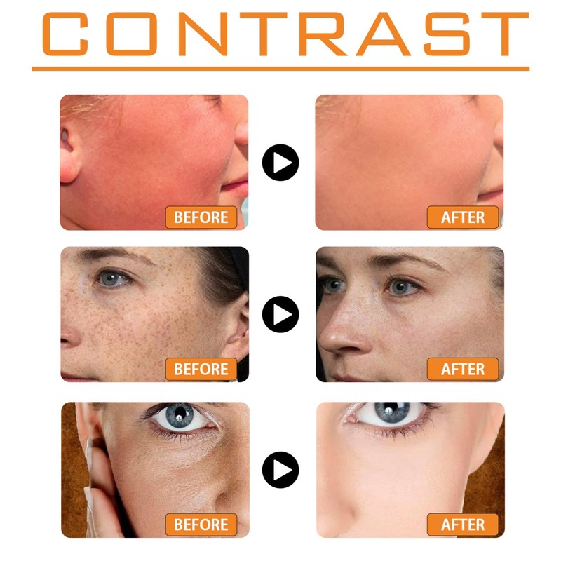 Sunscreen Spf 100 - Face Sunscreen - Waterproof Moisturiser with