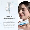 DR.melarxin Tranexamic Acid Cream 50ml | Targeted Treatment for Melasma,