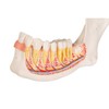 3B Scientific D25 6 Part Half Lower Jaw Model, 3