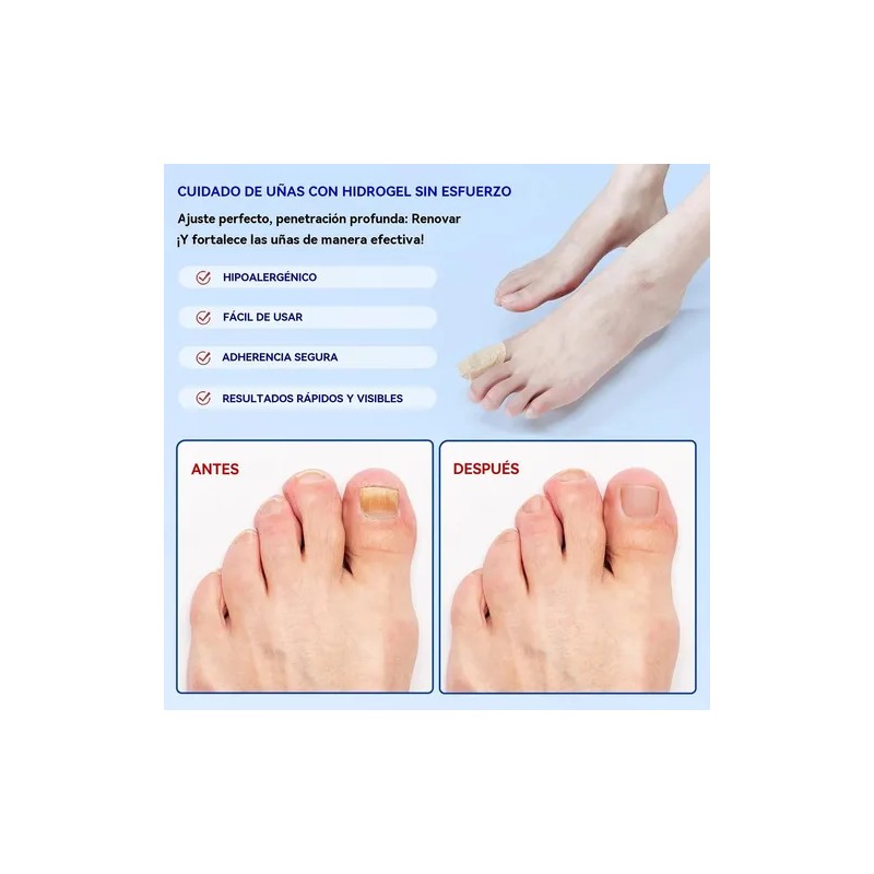 //fc Parches Para Uñas Fúngicos 63pcs/caja De Parches Para