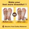 Electric Foot Callus Removers Rechargeable,Pedicure Tools for feet,Electronic Foot File