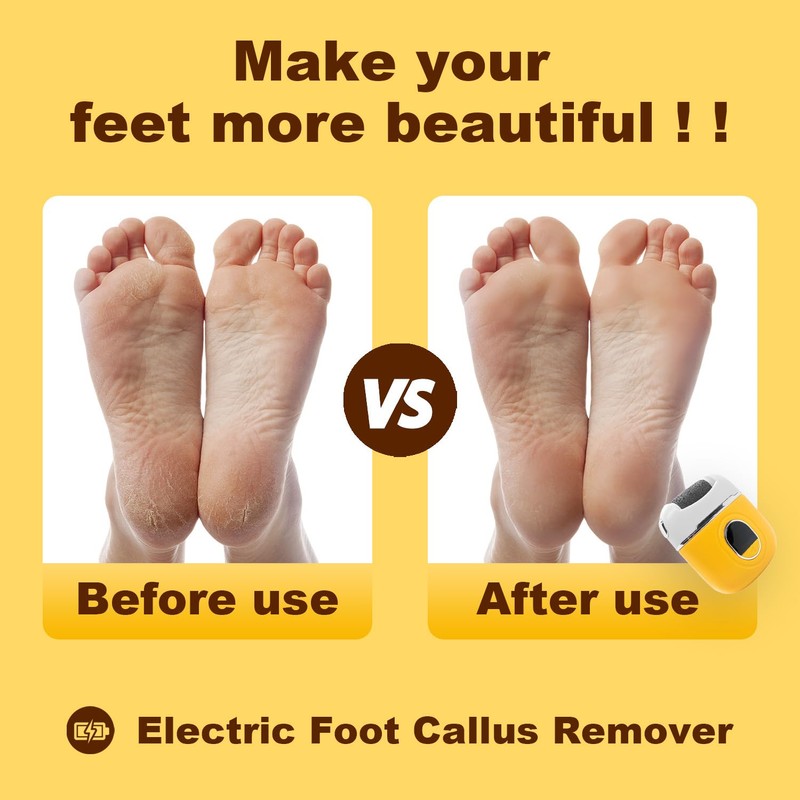 Electric Foot Callus Removers Rechargeable,Pedicure Tools for feet,Electronic Foot File