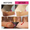 Crema Claradora Vitamínica Para Piel Oscura, Pigmento Mm