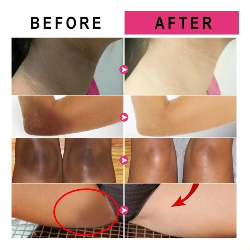 Crema Claradora Vitamínica Para Piel Oscura, Pigmento Mm