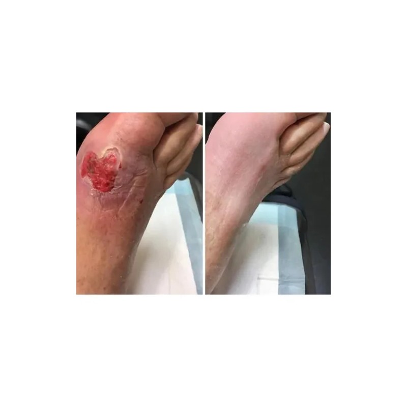 Crema Para Aliviar La Piel, Cuidado De Los Pies: Mantenga