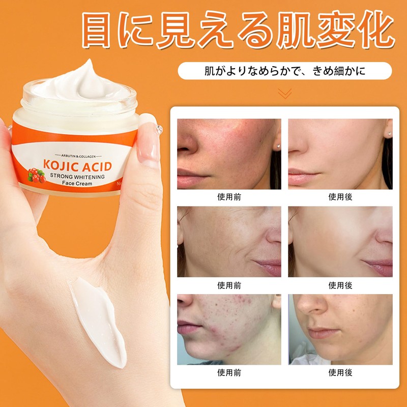 DOMATUS Kojic Acid whitening face cream, moisturizing and Mild Effect,