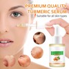 Turmeric and Vitamin C Face Serum, Turmeric Serum for Dark