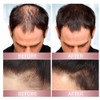 Vrpshe Hair Growth Spray with Rice Water – Biotin and
