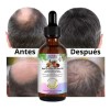 Aliver - Aceite Capilar Natural 11 Aceites Fortalecedor Kit 2pz