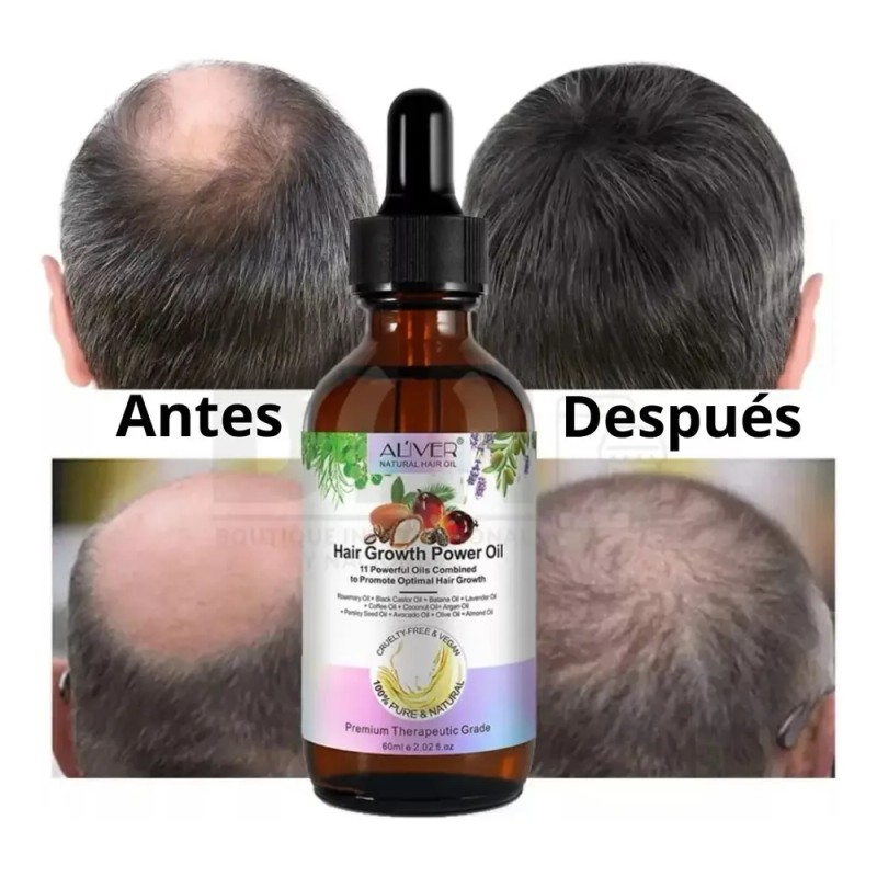 Aliver - Aceite Capilar Natural 11 Aceites Fortalecedor Kit 2pz