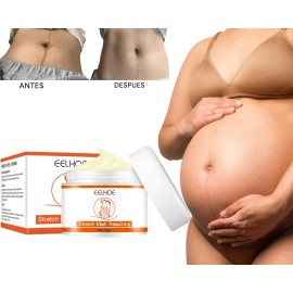Tratamiento Profesional Permanente Eliminar Estrías Neutra