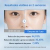 Medicube Pads Zero Pore 2.0 Exfoliantes Control Poros 70 Pzs