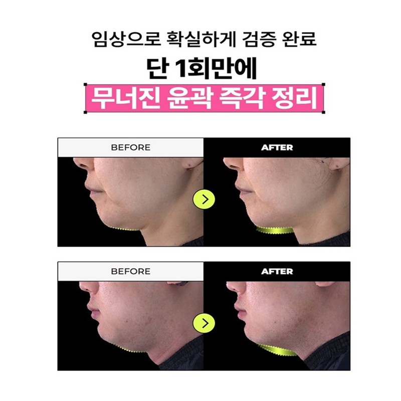 닥터빼 턱살제거 윤곽패치 V-Fit 브이핏 패치, 5개입, 1개 Dr. Bbae