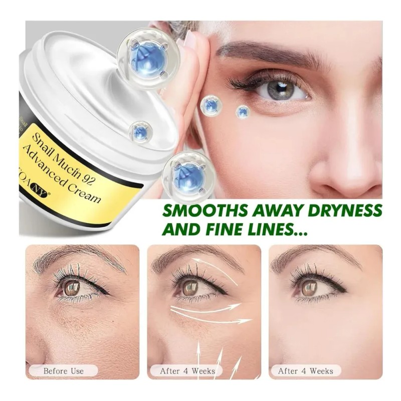 Hidratante Con Mucina De Caracol 92% Crema De Caracol, Esenc