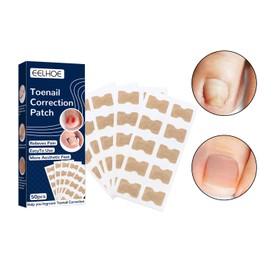 Cipszoely 50 PCS Ingrown Toenail Treatment, Painless Ingrown Toenail Corrector Nail Correction Patches Not Easy to Fall Off, Professional Safe Ingrowing Toenail Treatment for Ingrown Toenail Restoring