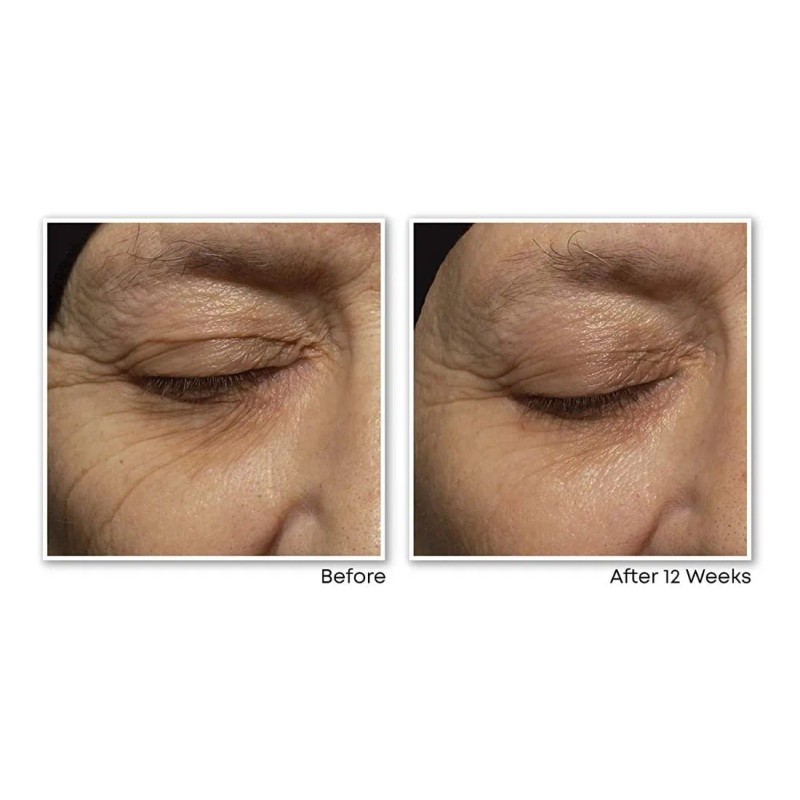 Roc Retinol Correxion Kit Cremas Día Y Noche Antiarrugas