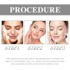 Crema Para Eliminar Manchas Oscuras Y Manchas Para Melasma Y