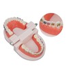 Dental Typodont Teeth Model with Metal Bracket, model fake braces
