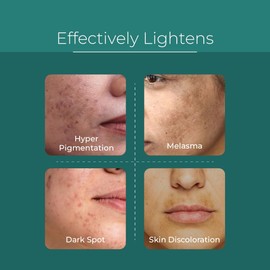 Pure & Cimple- EL MEJOR ELIMINADOR DE MANCHAS OSCURAS: el suero facial, superClarus Innovative Skin Brightener, está formulado con ingredientes eficientes que pueden penetrar profundamente en la piel,