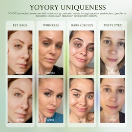 YOYORY Under Eye Patches Masks - for Eye Bags with Collagen and Hyaluronic Acid, Dark Circles,and Fine Lines, Fade Wrinkles Treatment for Women and Men - 60 Pcs Green