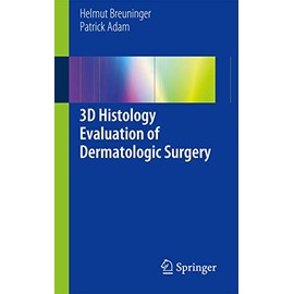 3D Histology Evaluation of Dermatologic Surgery