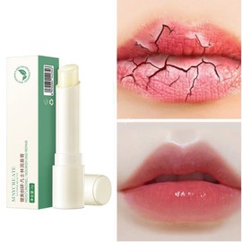 Enkomy Vaseline Lip Balm, Lippenbalsam Gegen Rissige Lippen ， Schützt Die Lippen Feuchtigkeitsspendender Lippenbalsam Vaseline Lip Therapy Männer Und Frauen