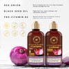 WOW Skin Science Red Onion Black Seed Shampoo & Conditioner