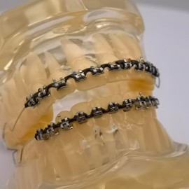 Funny and Fashion Fake Braces Kit With Two Color Teeth Braces Power Chain - Easy Stall For Orthodontist Dental Student Practice (No68-Yellow&Black)