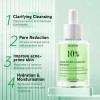 Serum Acido Azelaico 10 Y Hialurnico Piel Grasa Aclarante Grasa