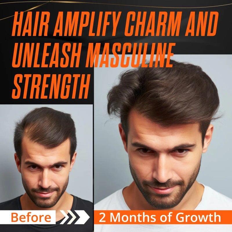 Sérum Para El Crecimiento Del Cabello Abera Abera Natural Co