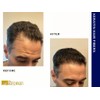 Revivogen MD Keratin Hair Building Fibers, Hairline Powder, Hair Fibers,