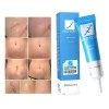 Gel Crema Cicatrizante Cuerpo Alliance Pharma Reductor Cicatrices Kelo Cote