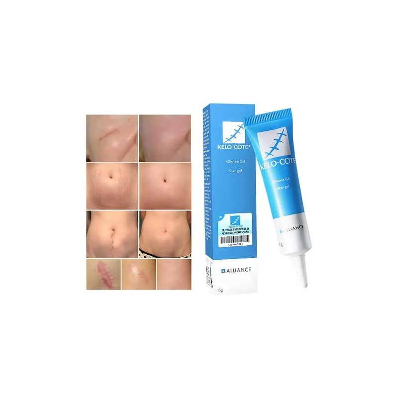Gel Crema Cicatrizante Cuerpo Alliance Pharma Reductor Cicatrices Kelo Cote