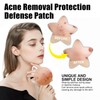48 Packs Pimple Patches for Large Breakouts, Zit and Blemish,