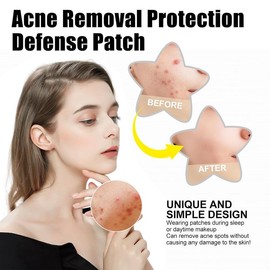 48 Packs Pimple Patches for Large Breakouts, Zit and Blemish, Large Acne Patches Skincare Blend Hydrocolloid Skin Repair