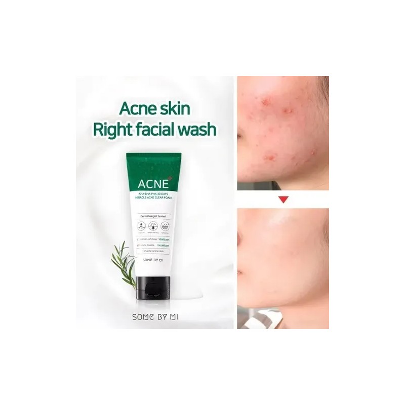 Espuma Limpiadora Some by Mi Miracle Acne Foam 100ml Antiacné