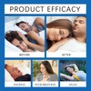Anti Snoring Devices, Snore Stopper with Adjustable Magnet, Silicone Nose