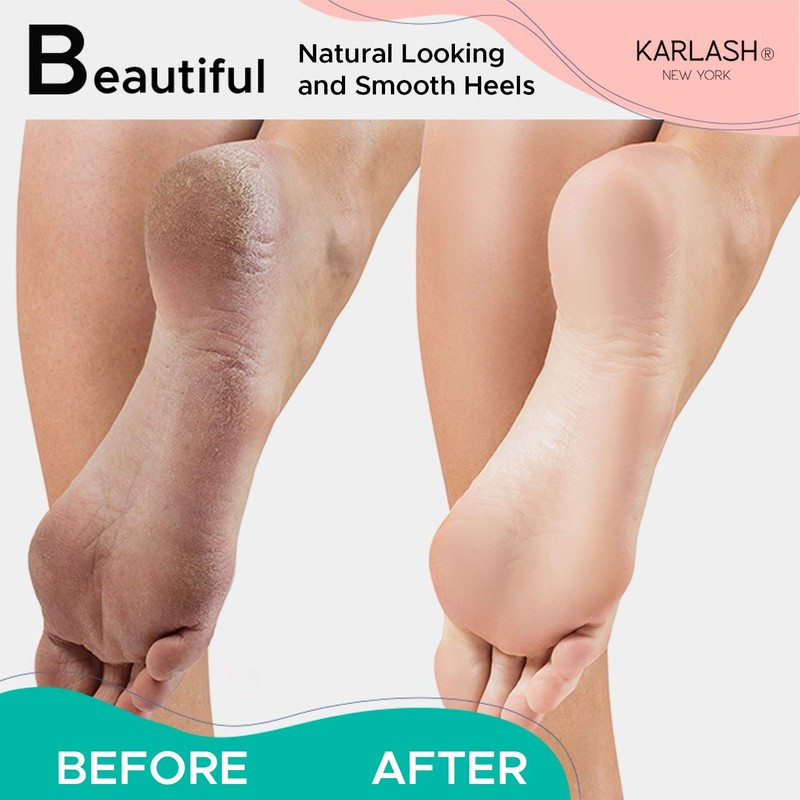 Karlash 2-Sided Nickel Foot File for Callus Trimming and Callus