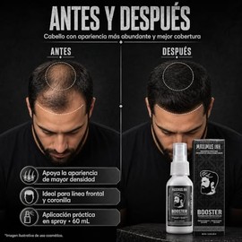 Maximus Tnico para Barba Tupida y Cabello  Tratamiento Anticada Concentrado al 20  Rellena Huecos y Aumenta Densidad  Locin para Crecimiento...       