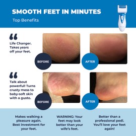 Own Harmony Electric Callus Remover: Own Harmony Professional Pedicure Tools Foot Care for Women, Rechargeable Foot Scrubber, CR900 Electronic Feet File Pedi Sander Best for Hard Cracked Dry Dead Skin, 3 Rollers