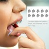 Healifty 30 botones linguales de ortodoncia dental con base redonda