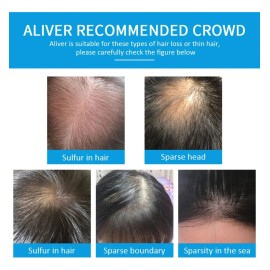 Fibras Capilares Con Queratina Disimula Calvicie  Entradas                                                                                            