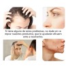 Shzhdikun Glwz 0.5mm 1200 Microagujas Dermaroller Hair Roller Barba Cabello