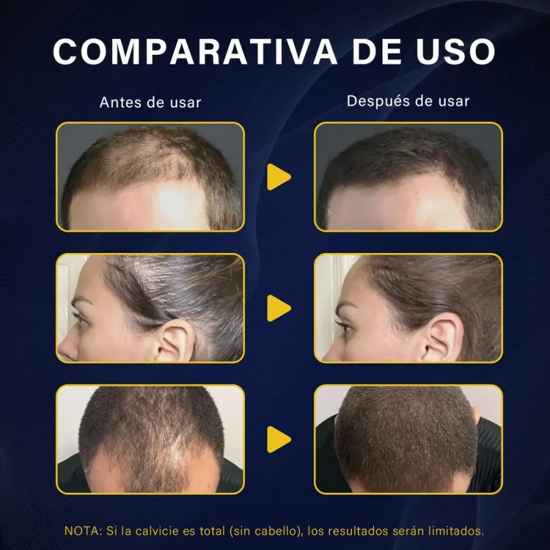 Lunixila Fibras Capilares 100g Relleno Cubre Calvicie Negro
